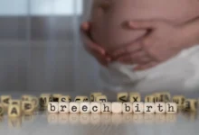 What Is Breech Birth