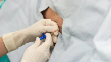 What Is an Epidural